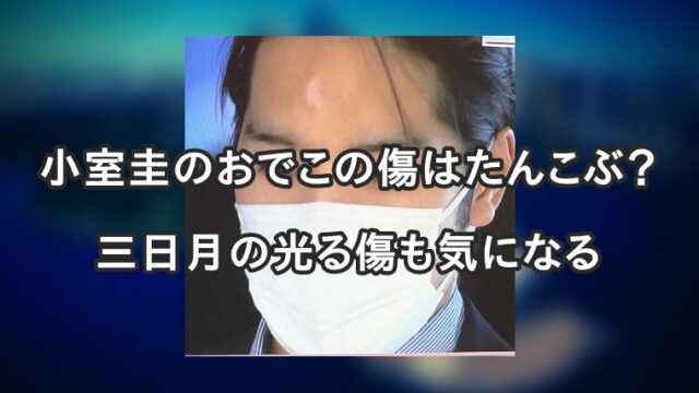 小室圭のおでこの傷は何 たんこぶや三日月マークが気になるｗｗ Juicy News